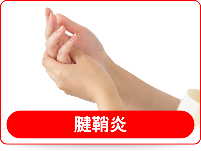 腱鞘炎